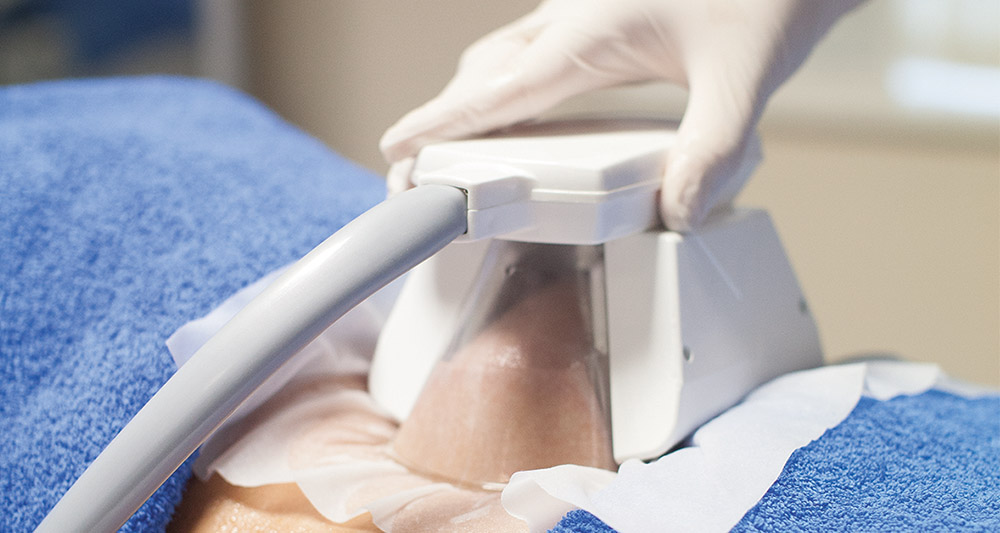 How Fat Freezing and HIFU Work Together? 2 Multiple Areas in One Session HIFU and Fat Freezing Felixstowe