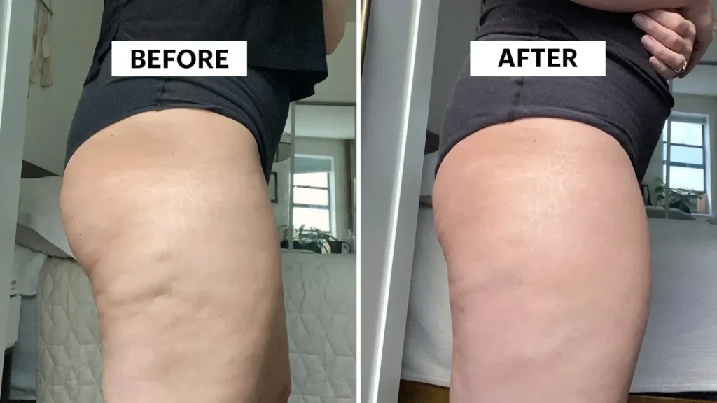 Do Toning Exercise Felixstowe Really Tackle Cellulite?