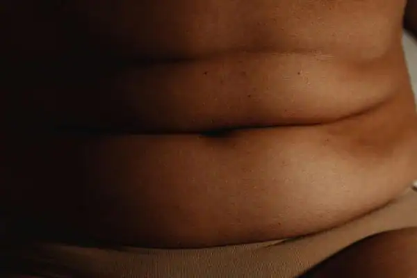 The Hidden Connection: How Stress Shapes Your Fitness and Body Composition 3 image of what stress can do on the stomach area and how Lipo 360 Felixstowe can help to change your body shape.