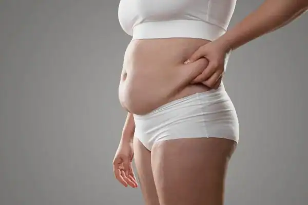 Image of stress belly Felixstowe How Lipo 360 can help manage your symptoms